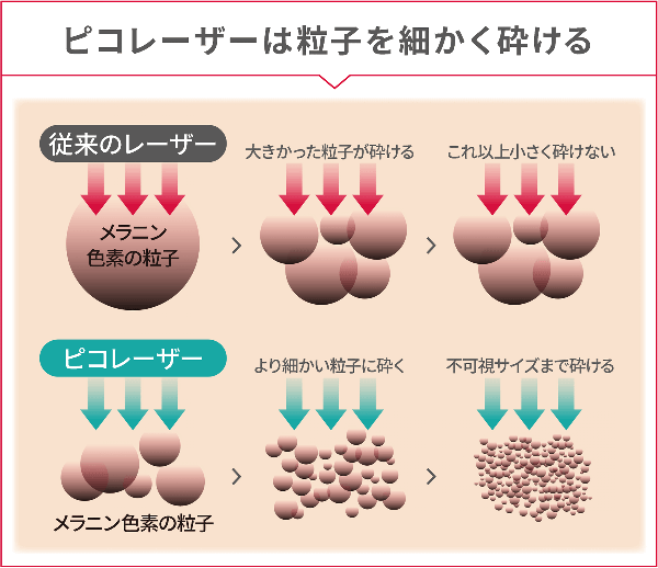 ピコレーザーは粒子を細かく砕ける